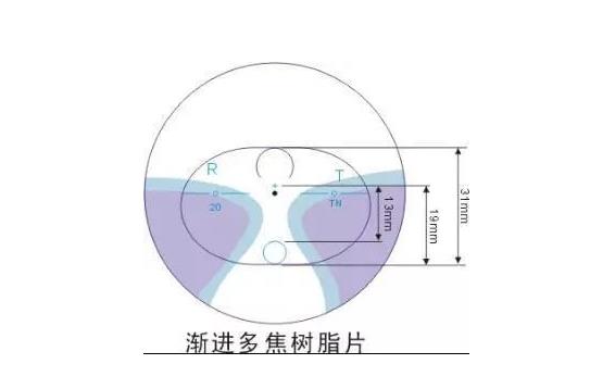 美丽岛渐进多焦镜适合的人群，需要注意的事项