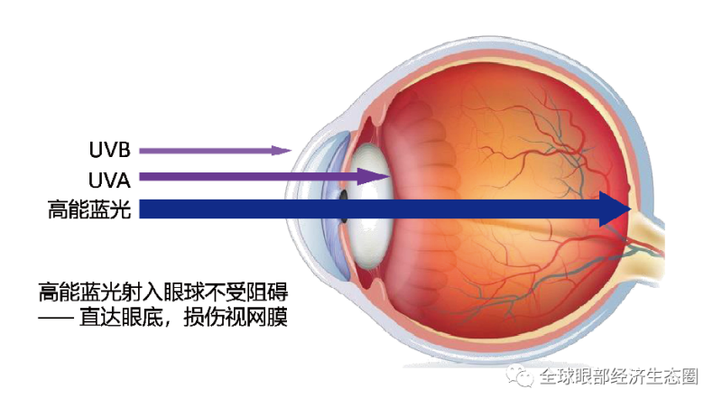 你的防蓝光眼镜戴对了吗